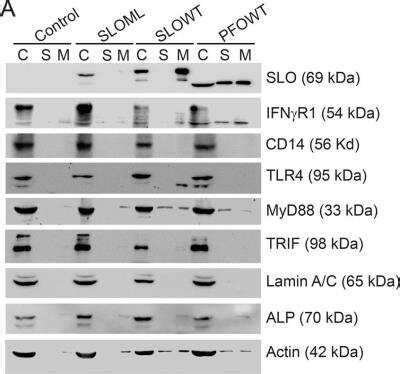 Streptolysin Antibodies: Novus Biologicals