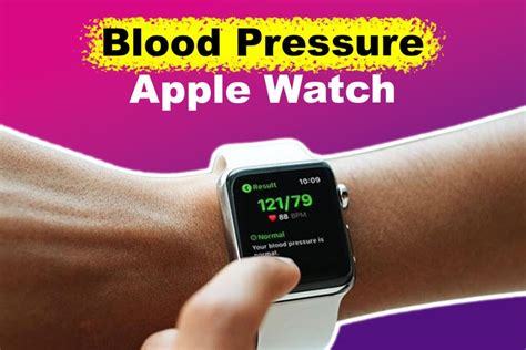 Monitoring Blood Pressure via Apple Watch [The Right Way!] - Alvaro ...