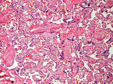 File:Placenta histology 004.jpg - Embryology