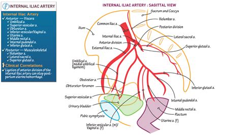 Usmle Comlex Step Internal Iliac Artery Draw It To | My XXX Hot Girl