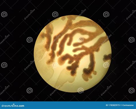 Branched Bacterial Colonies Under the Microscope Stock Image - Image of ...