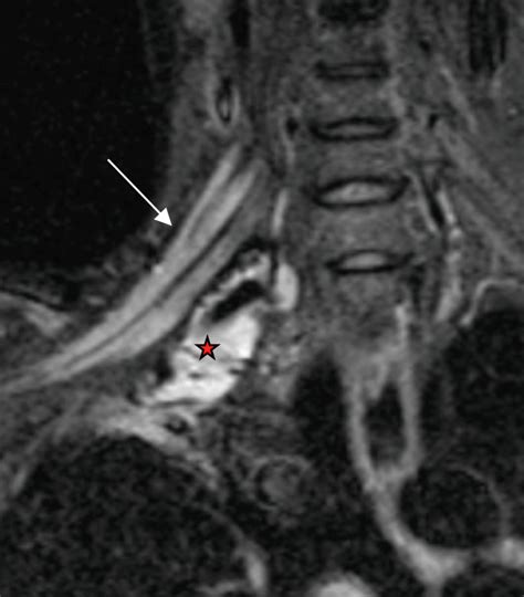 Peripheral Nerve Imaging – Hawaii Diagnostic Radiology Services by Y&M