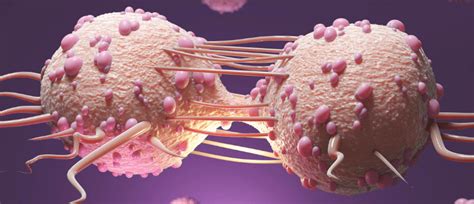 Malignant phyllodes tumor of the breast: case report, tumor characteristics, treatment approach ...