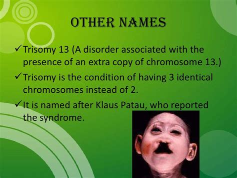 Patau Syndrome