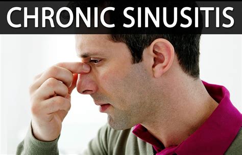 Chronic Sinusitis - Causes, Symptoms, Surgery, and Treatment