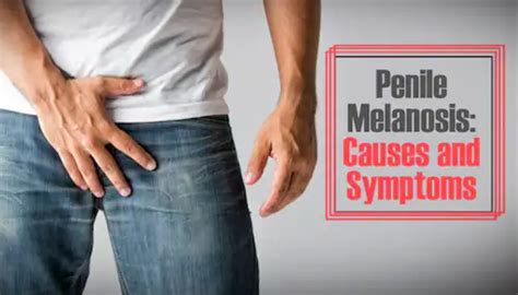 Penile Melanosis: Causes, Symptoms, and Treatment Options