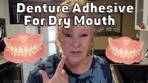 Best Denture Adhesive for DRY MOUTH - YouTube