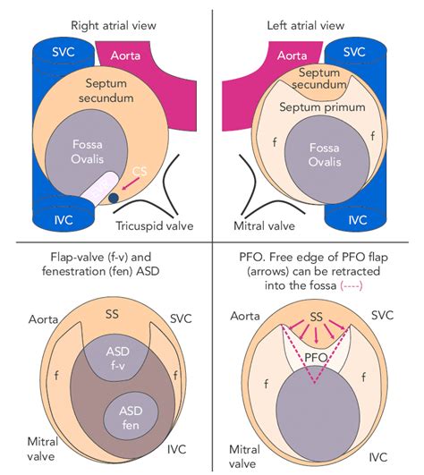 Anatomy Of Interatrial Septum With Permission From Teachmeanatomy | Images and Photos finder