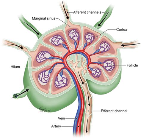 Imaging Updates to Breast Cancer Lymph Node Management | RadioGraphics