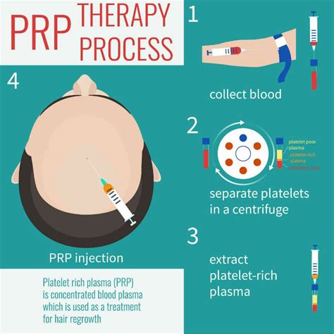 What is PRP Treatment - Therapy Procedure For Hair Loss