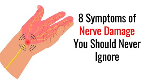 8 Symptoms of Nerve Damage You Should Never Ignore - WomenWorking