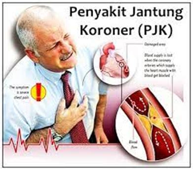 Penyakit Jantung Koroner dan Pencegahannya