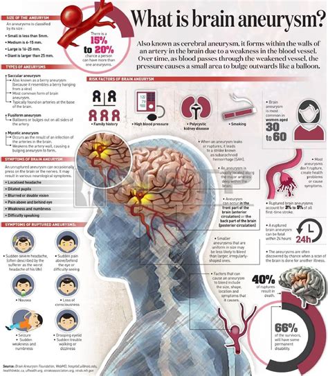 Brain Aneurysm Symptoms : Warning Signs And Symptoms Of A Brain Aneurysm Dr Vipul Gupta : Read ...