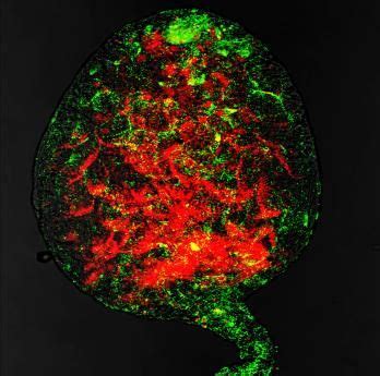 Real Monstrosities: Wolbachia