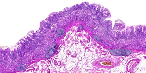 A Beginner's Guide to Haematoxylin and Eosin Staining