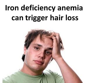 Secondary causes of hair loss – Endhairloss.eu