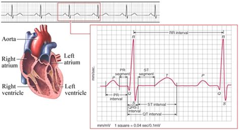 ECG Research