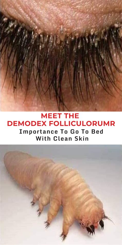 Meet the Demodex Folliculorum-Importance of removing your make-up ...