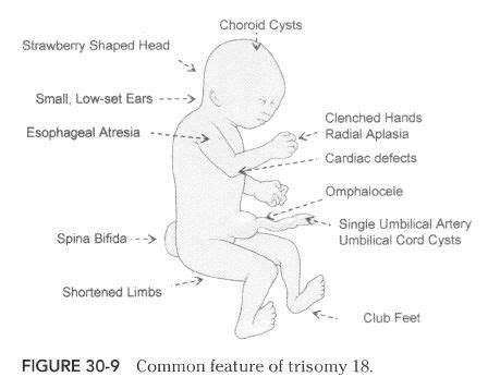 Pin on Ultrasound