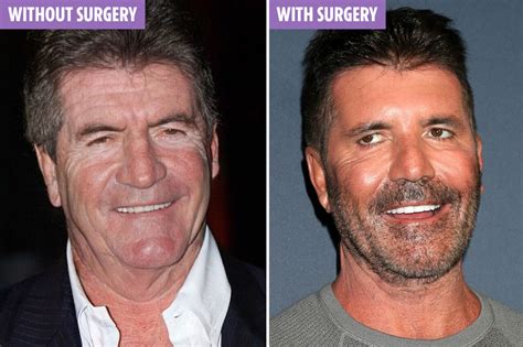 Simon Cowell's 'REAL' face without Botox and plastic surgery revealed ...