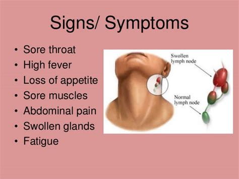 Mononucleosis - Homeopathic treatment by Doctor Tsan in Philadelphia