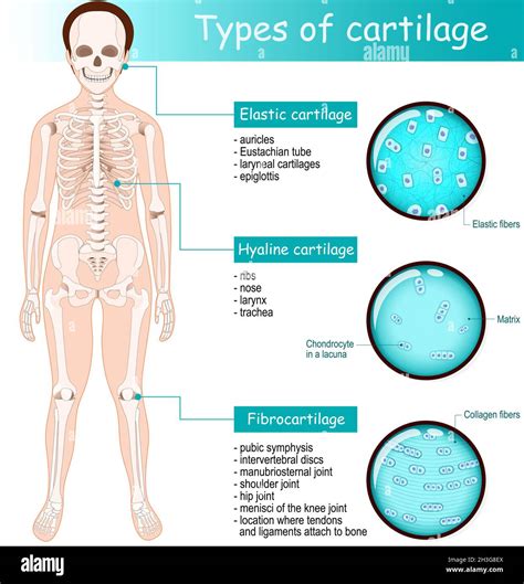 Types of cartilage: Fibrocartilage, Hyaline and Elastic. Human skeleton with joints. Close-up of ...