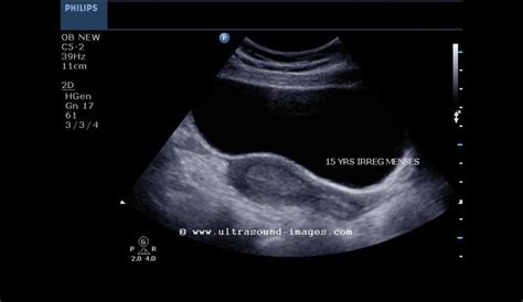 Ultrasound imaging: September 2012