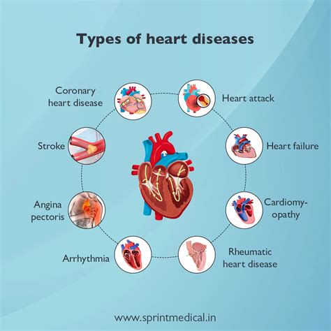 Coronary Artery Disease Risk Factors