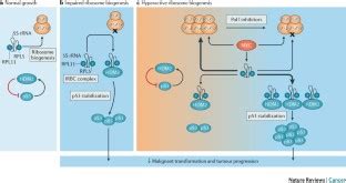 Ribosome biogenesis in cancer: new players and therapeutic avenues ...