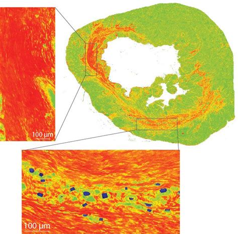 Cardiac Tissue Engineering | Desai Lab | UCSF