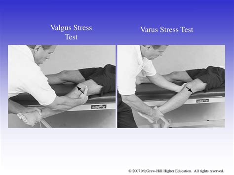 PPT - Chapter 16: The Knee and Related Structures PowerPoint ...