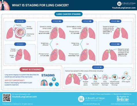 What is Staging for Lung Cancer?