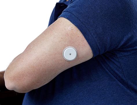 Abbott's Euro approved wearable glucose monitor is different than anything on the market ...