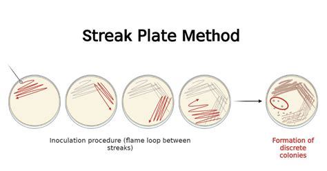 streak plate method lab report - Jennifer Dyer