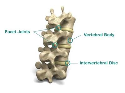 Facet Joint Pain – iSPINE