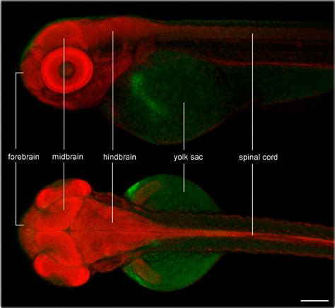 Zebrafish Embryo Brain