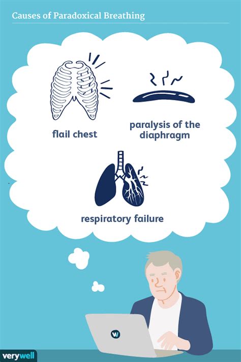 Paradoxical Breathing: Symptoms, Causes, and Treatment