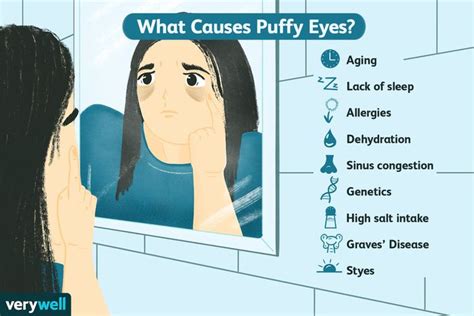 What Causes Puffy Eyes?