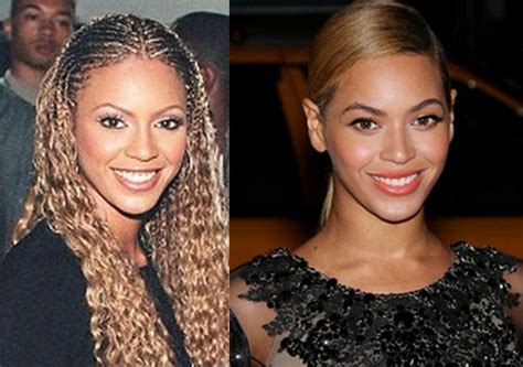 Pin on Beyonce Skin Bleaching Secret