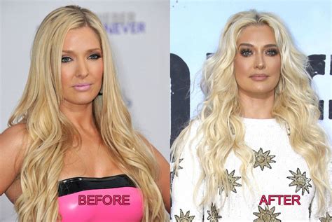 PHOTOS: See RHOBH's Erika Jayne Plastic Surgery Before & After Pics ...