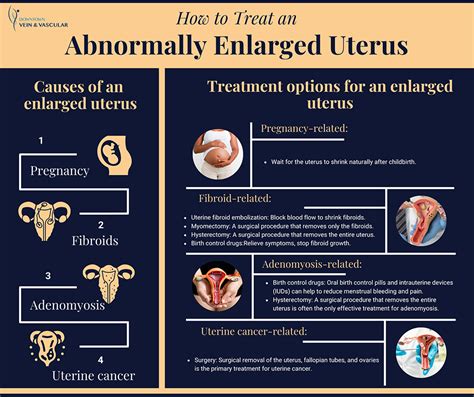 Enlarged Uterus Treatments in Downtown Brooklyn, New York - Downtown Vein & Vascular