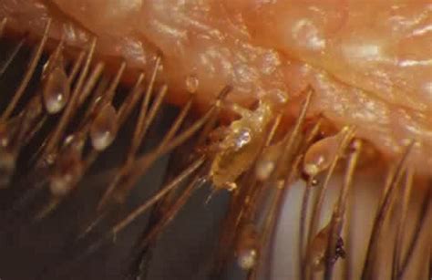 Electron microscopy photos - Imgur | Eye mites, Eyelash mites, Eyelashes