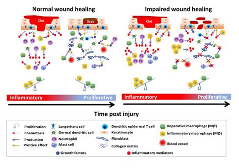 Schematic of normal and impaired wound healing. The inflammatory phase ...