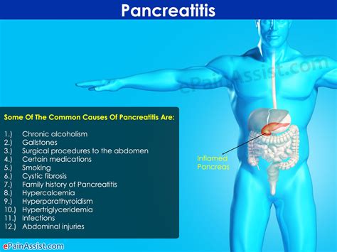 What Causes Pancreatic Pain - Cares Healthy