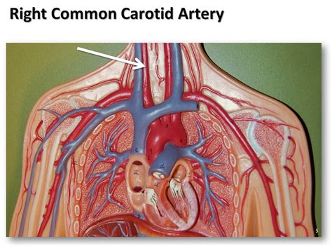Right common carotid artery - The Anatomy of the Arteries … | Flickr