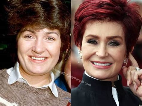 Sharon Osbourne: BEFORE and AFTER