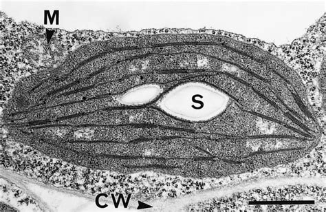 Ulothrix Chloroplast Shape