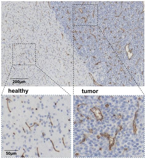 Cluster of differentiation 31 (CD31) antibody staining was applied to ...