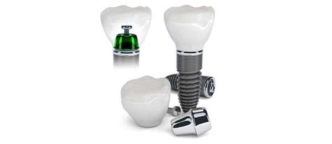 Implant prosthodontics - Dubrovnik Dental Clinic