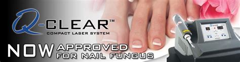 Toenail Fungus - Laser Therapy - Miami & Hialeah Foot Doctor ...